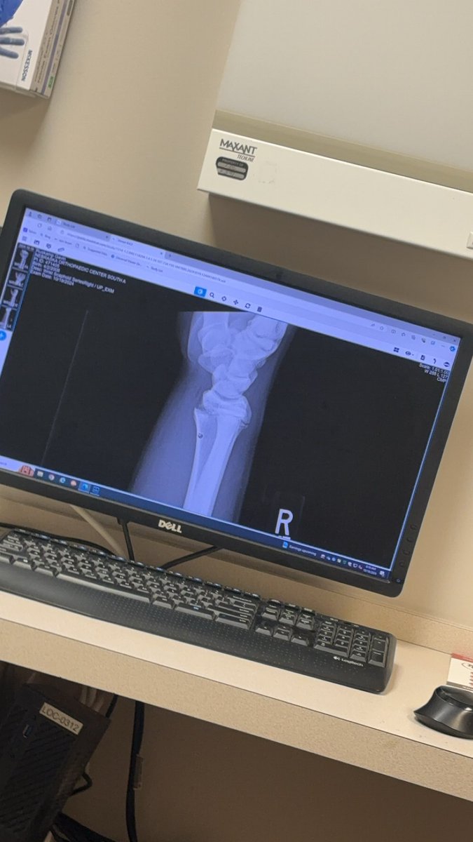 Unfortunately, my football season is over due to a wrist injury. It’s really frustrating that my season ended this way, but I will come back stronger. For the rest of this season, I’m going to focus on becoming a true student of the game and help my team in any way I can. #hwpo