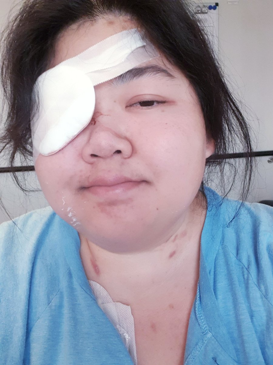 Yensitive's tweet photo. Cant type 100% but will announce a long hiatus to heal after surgery on my right eye. Left is planned ahead. So much going on https://t.co/PbrCZquYS0