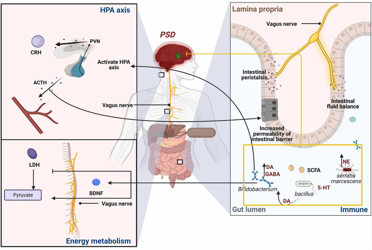 Effect of the gut microbiota on post-stroke depression (PSD) via neurotransmitters (NTs) and the vagus nerve.