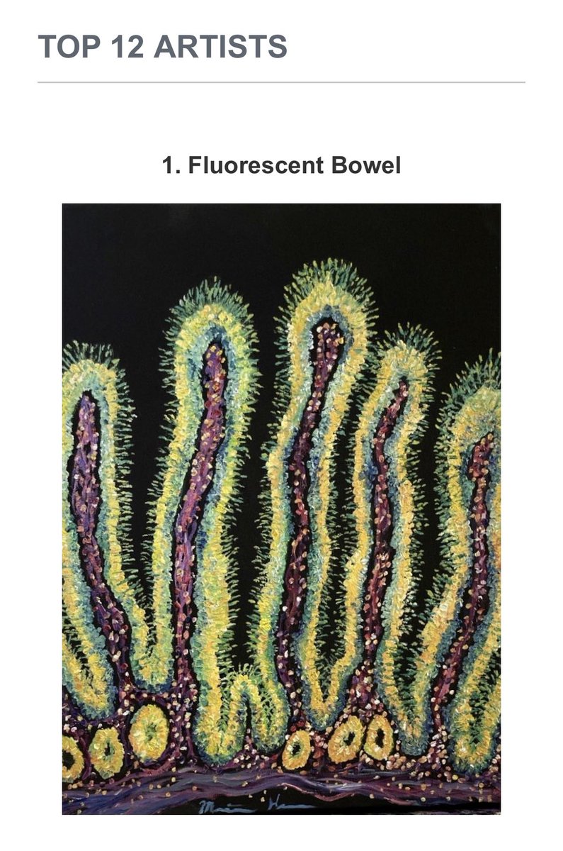 Meredith Herman, DO (@meredithkherman) on Twitter photo Reminder to cast your vote for your favorite top art entry in the CAP events app #cap24 <a href="/Pathologists/">CAPathologists</a> <a href="/UMichPath/">Michigan Pathology</a>
#pathart Reminder to cast your vote for your favorite top art entry in the CAP events app #cap24 <a href="/Pathologists/">CAPathologists</a> <a href="/UMichPath/">Michigan Pathology</a>
#pathart