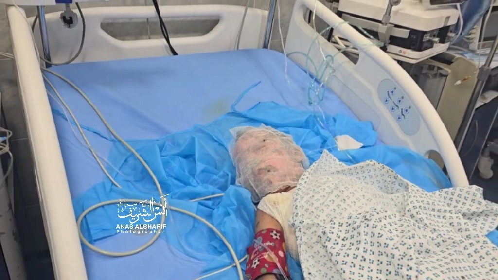 AnasAlSharif0's tweet photo. أطفال يصارعون الموت داخل مستشفى كمال عدوان المحاصر في شمال غزة مع نقص المستلزمات الطبية و استمرار القصف والغارات والحصار
#شمال_غزة_يباد https://t.co/BLkGlRC8EL
