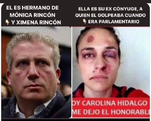 Miguel Frías Recabarren 🇵🇸Libre tweet media