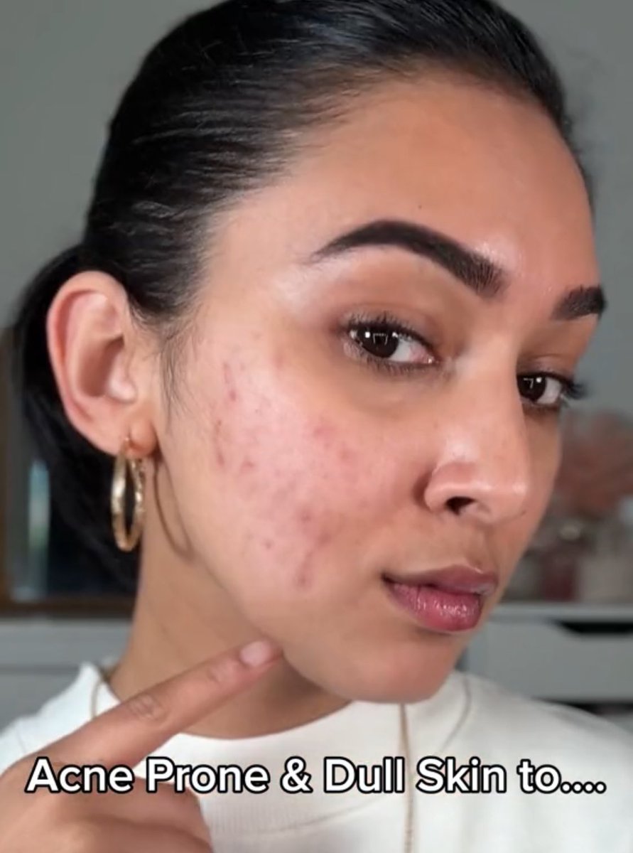 _mimisaidi's tweet photo. I dah jumpa cara paling malas kita boleh buat untuk jaga muka tapi dapat result mantap gila! 

Bagi masa seminggu je glowing terus 🤌🏻🫶🏻 https://t.co/jtSy5F0woh