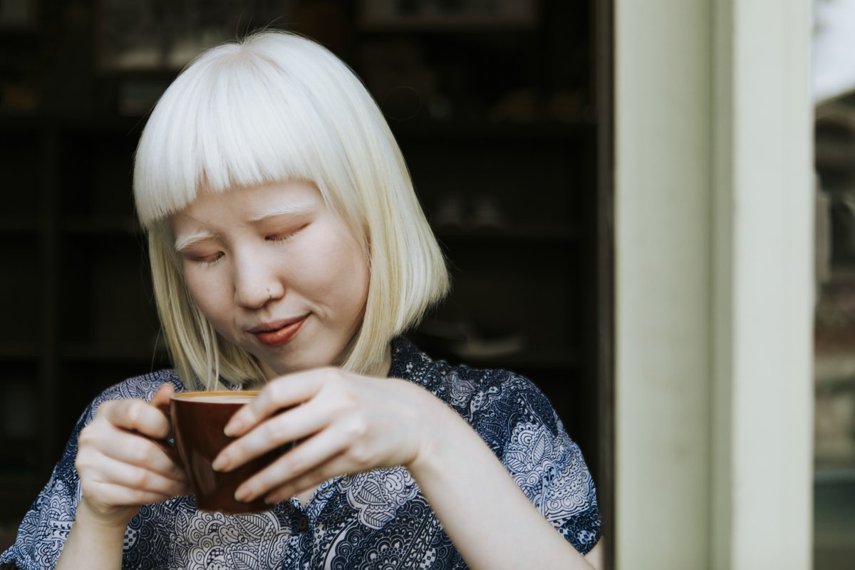 UN Special Procedures (@un_spexperts) on Twitter photo USA 🇺🇸: Wider action needed to improve lives of all persons with albinism & HPS, says UN expert <a href="/UnAlbinism/">UN Independent Expert on Albinism</a> concluding her visit to the country, urging action to remedy glaring disparities in access to services, including education, health & employment.
ohchr.org/en/press-relea… USA 🇺🇸: Wider action needed to improve lives of all persons with albinism & HPS, says UN expert <a href="/UnAlbinism/">UN Independent Expert on Albinism</a> concluding her visit to the country, urging action to remedy glaring disparities in access to services, including education, health & employment.
ohchr.org/en/press-relea…