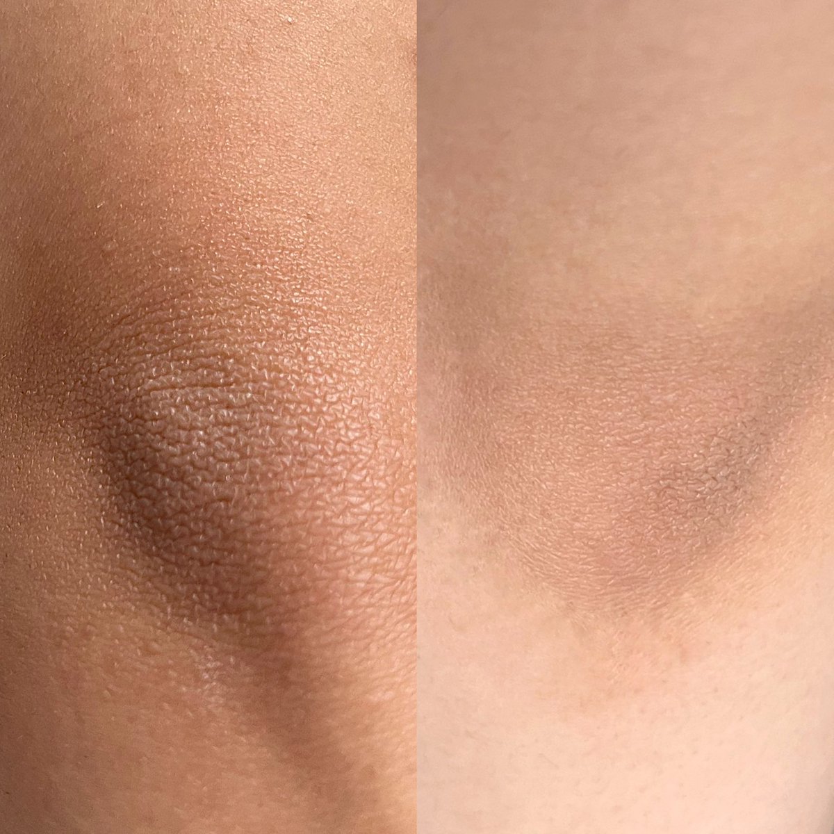 cattyable's tweet image. THE REAL KONSISTEN kalau mau siku kamu kaya gini!😍 belum perfect sih, tapi udah keliatan hasilnya✨ #HanaHonestReview