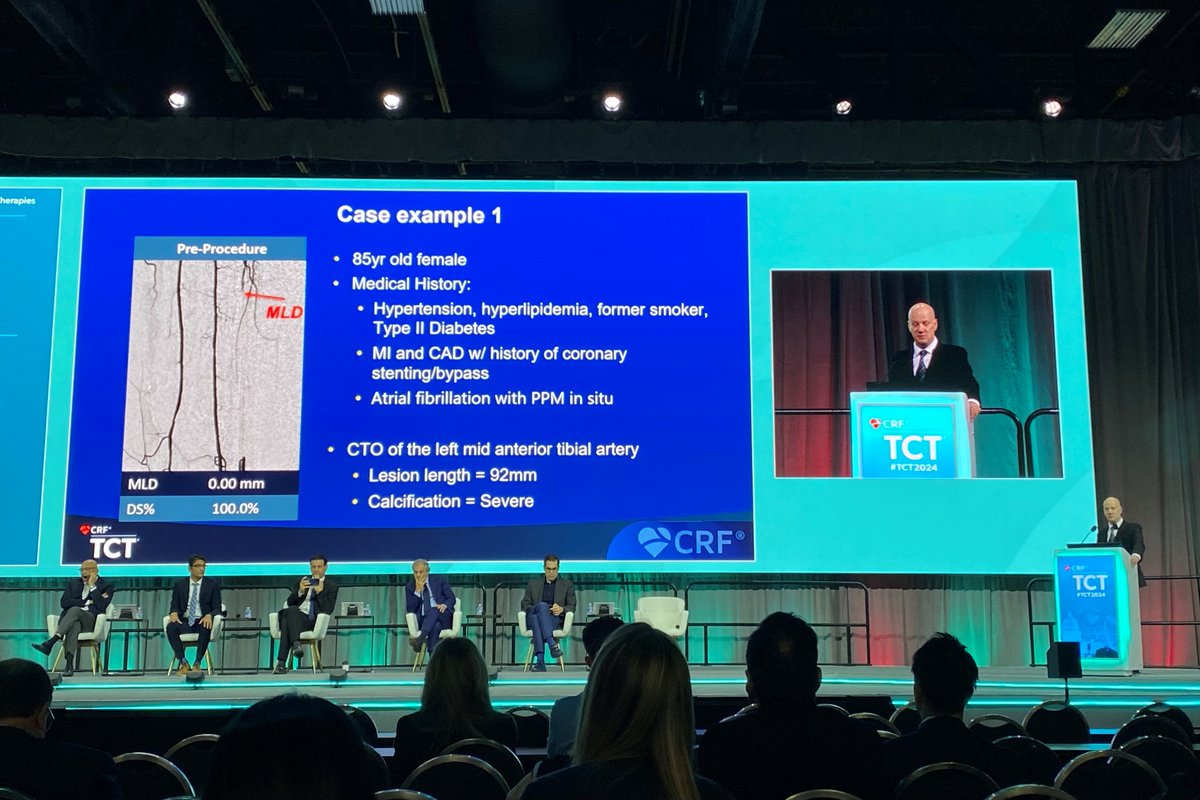 Shockwave Medical tweet media