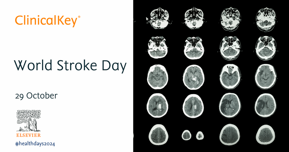 NBT Library and Knowledge Service (@nbt_library) on Twitter photo Today is #WorldStrokeDay2024
For articles, books or other resources on this or any other clinical area, search the online NHS Knowledge & Library Hub, or📨southmead.library@nbt.nhs.uk
<a href="/ASCRnbt/">AwesomeASCR</a> <a href="/MedicineNbt/">MedicineNBT</a> <a href="/NmskNbt/">NMSK at North Bristol Trust</a> <a href="/NSnahper/">NBT_SNAHPer</a> <a href="/acutemedicalnbt/">Acute Medical Unit @NBT</a> <a href="/EducationNBT/">ClinicalEducationNBT</a> <a href="/nbt_ed/">nbt_ed</a> <a href="/ResearchNBT/">Research at North Bristol NHS Trust</a> Today is #WorldStrokeDay2024
For articles, books or other resources on this or any other clinical area, search the online NHS Knowledge & Library Hub, or📨southmead.library@nbt.nhs.uk
<a href="/ASCRnbt/">AwesomeASCR</a> <a href="/MedicineNbt/">MedicineNBT</a> <a href="/NmskNbt/">NMSK at North Bristol Trust</a> <a href="/NSnahper/">NBT_SNAHPer</a> <a href="/acutemedicalnbt/">Acute Medical Unit @NBT</a> <a href="/EducationNBT/">ClinicalEducationNBT</a> <a href="/nbt_ed/">nbt_ed</a> <a href="/ResearchNBT/">Research at North Bristol NHS Trust</a>