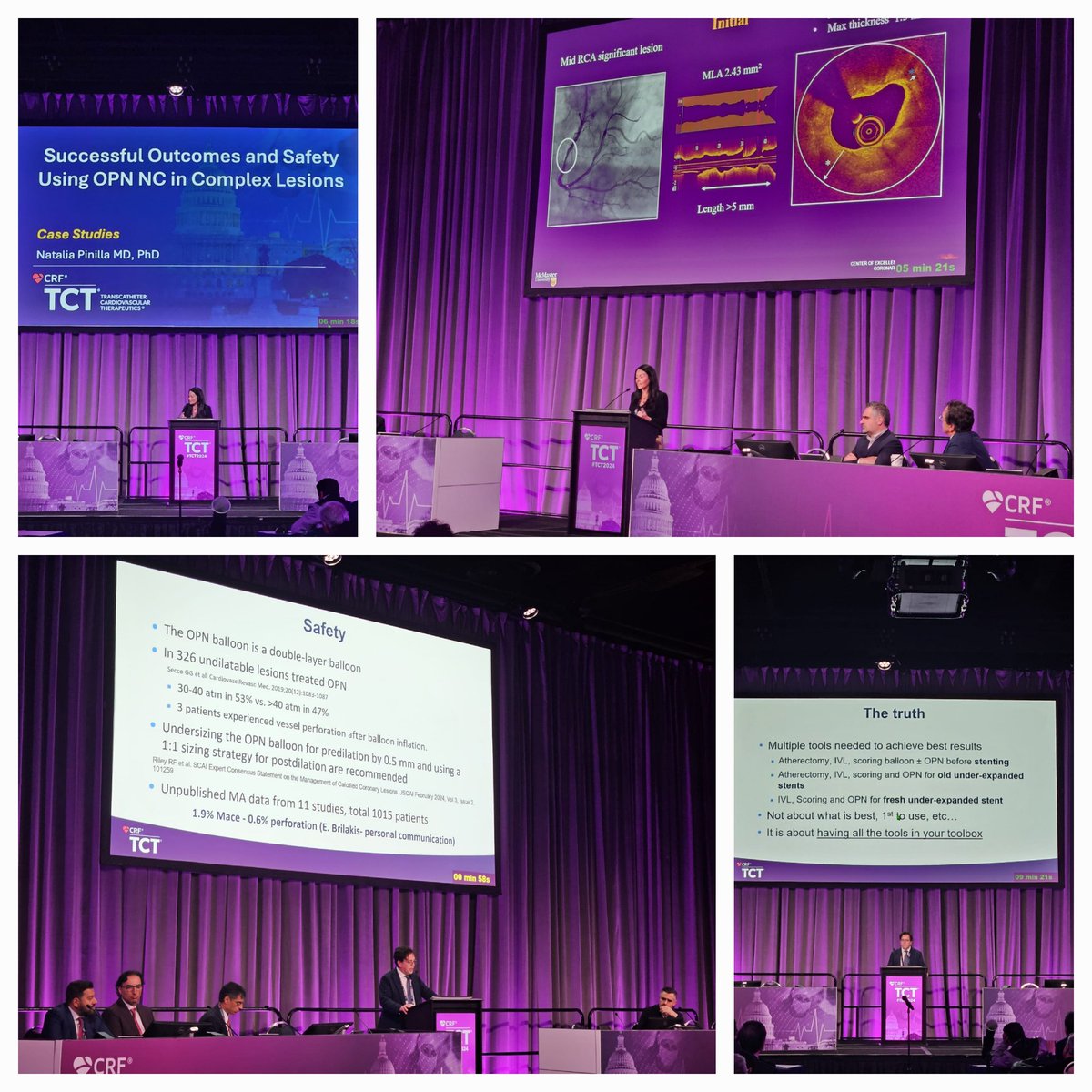 SIS Medical (@sis_medical) on Twitter photo "To treat an old story, we need new tools ". <a href="/RinfretStephane/">Stéphane Rinfret, MD SM</a> &
<a href="/DrNataliaP/">Natalia Pinilla</a> on stage talking about safely of #OPN in complex lesions "To treat an old story, we need new tools ". <a href="/RinfretStephane/">Stéphane Rinfret, MD SM</a> &
<a href="/DrNataliaP/">Natalia Pinilla</a> on stage talking about safely of #OPN in complex lesions