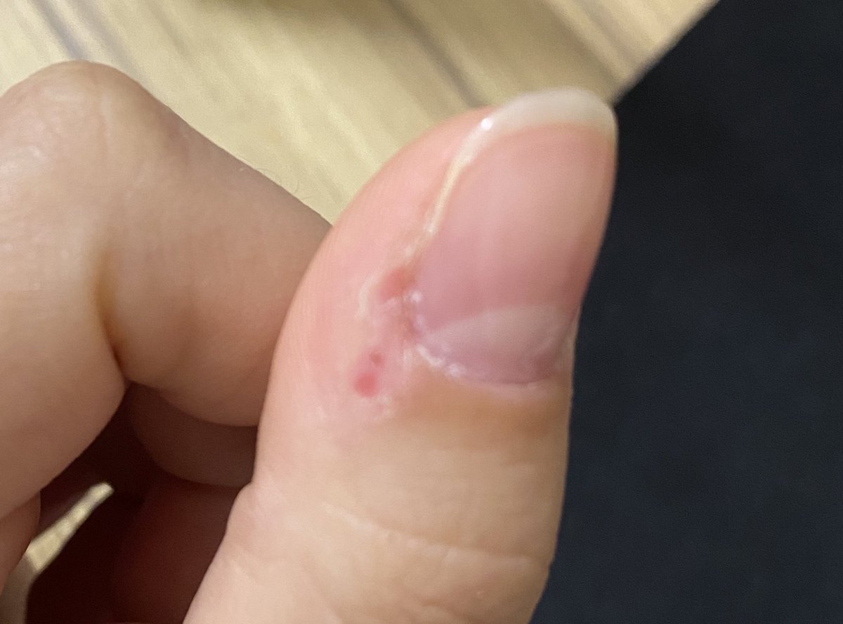 En sağlam tırnağım