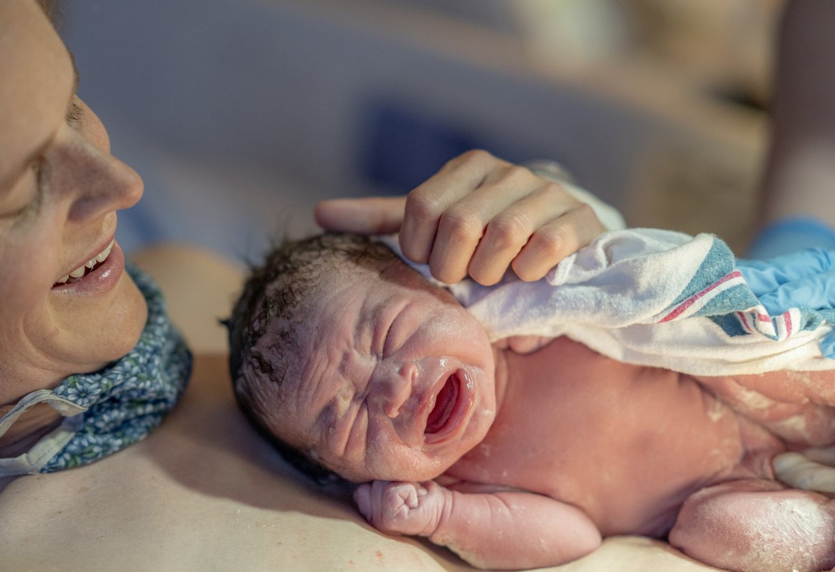 ontariomidwives's tweet image. Deferred (or delayed) cord clamping is a longstanding practice among #Ontariomidwives and is now widely considered a standard of care. See how midwifery data can be used to support informed choice discussions around this recommended practice: ontariomidwives.ca/sites/default/…