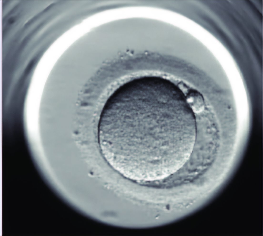 culpable_mink's tweet image. The fundamental problem in embryology is that you have to get from a single cell to a complex organism that is not symmetrical in two different axes, and about 10 orders of magnitude.

Oh, and everything must work at all times while growing. 2/13