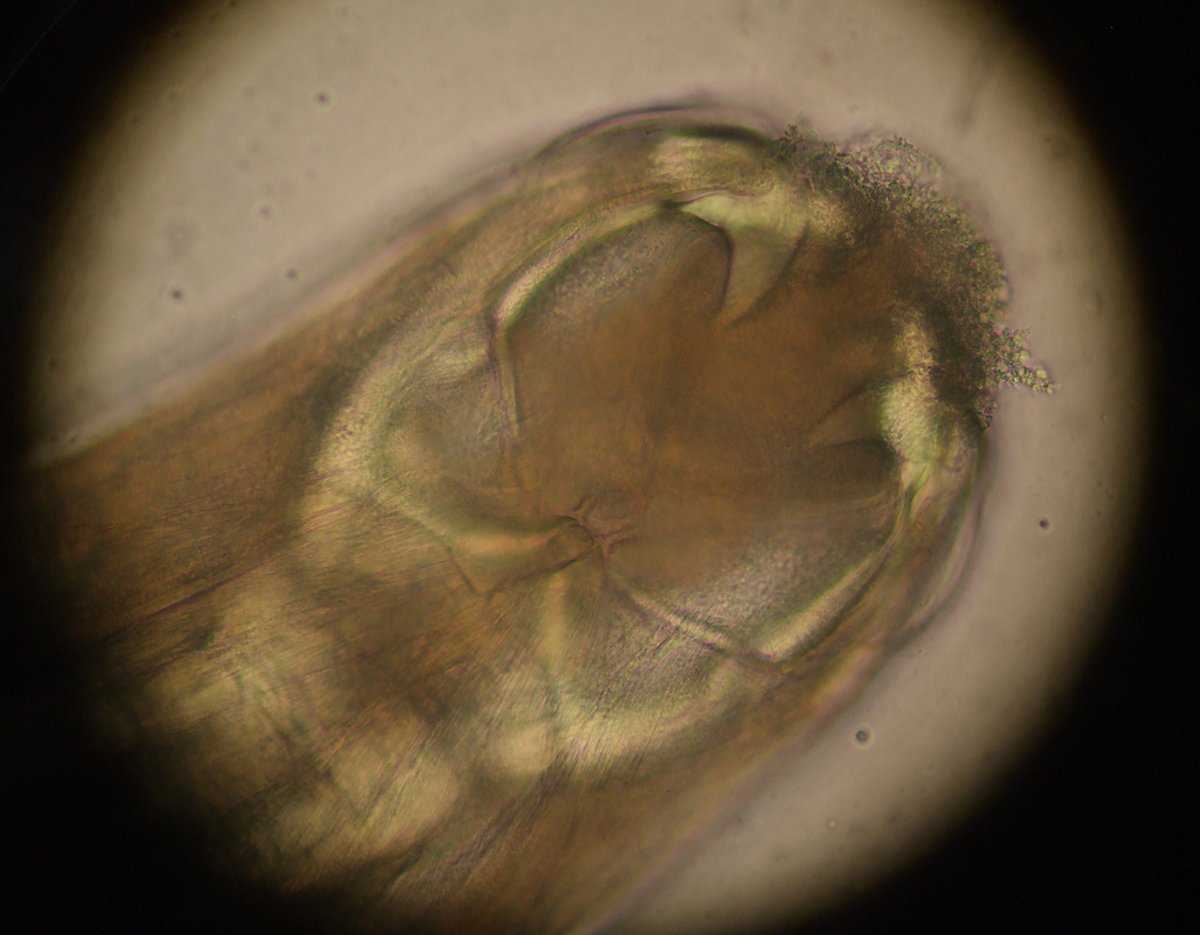 #Parasite case 759 is up – just in time for Halloween! This worm was found in the terminal ileum during screening colonoscopy (Patient was asymptomatic). Diagnosis?