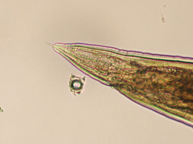 ParasiteGal's tweet photo. #Parasite case 759 is up – just in time for Halloween! This worm was found in the terminal ileum during screening colonoscopy (Patient was asymptomatic). Diagnosis? https://t.co/fTqhJV3PBp