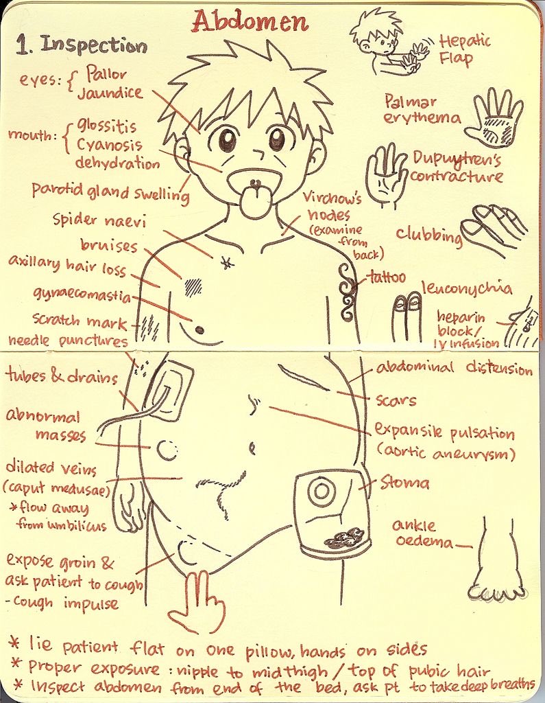 OGdukeneurosurg's tweet photo. Exam of abdomen https://t.co/ia8HtoyjV9