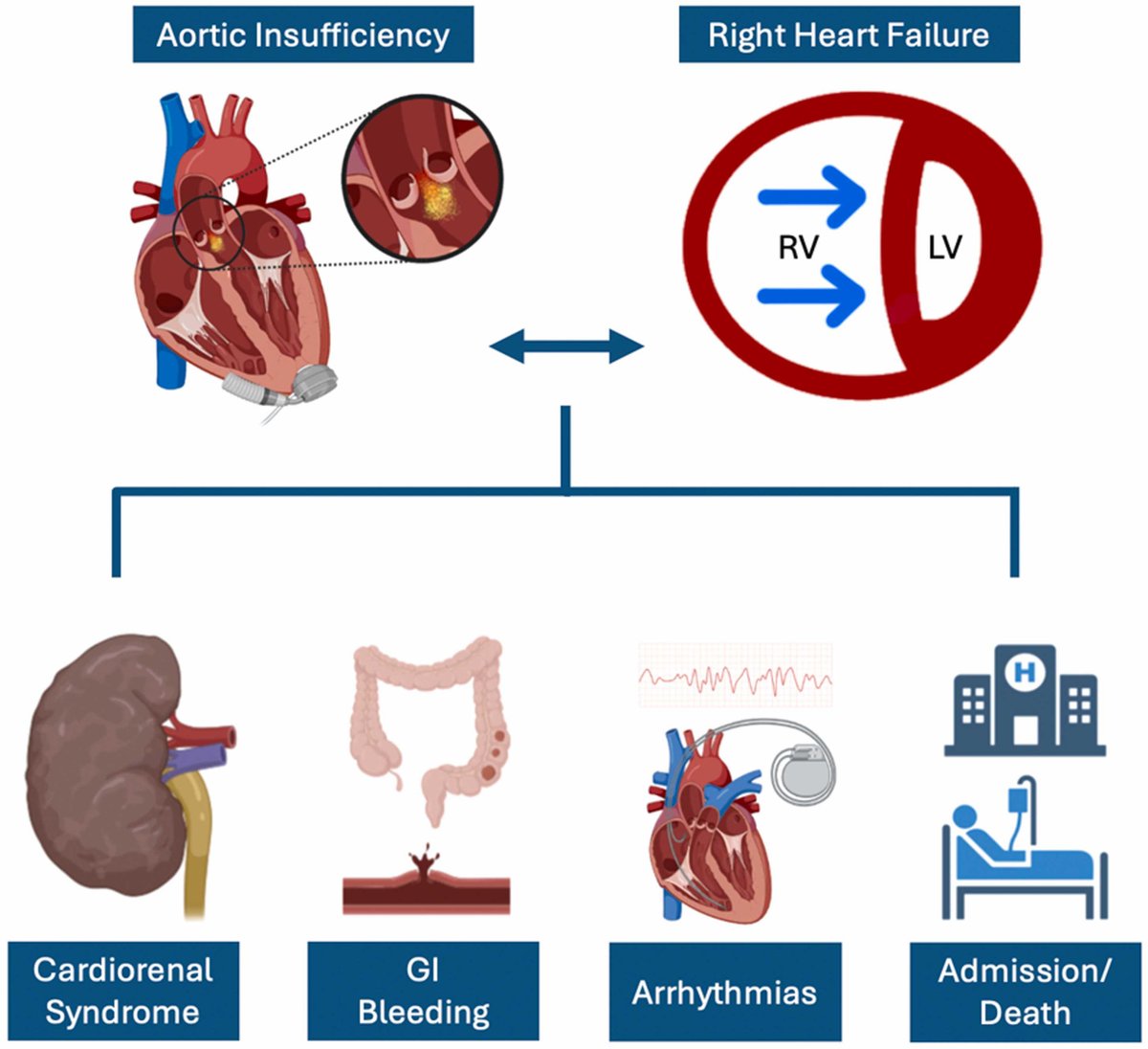 State of the Art review on Aortic Insufficiency on HM3- 
❓ What does the new HM3 data show? Where are the field’s gaps? Contemporary data summary provided herein. <a href="/preventfailure/">Jennifer Cowger</a> 

🔗: jhltonline.org/article/S1053-…