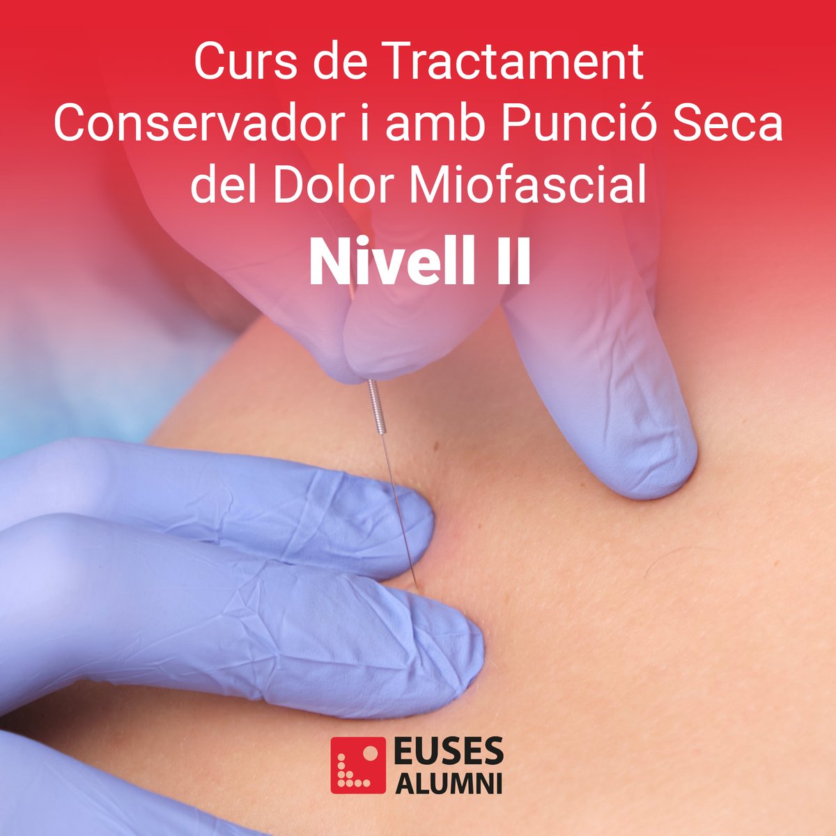 🚨🧐 Per desè any, hem exhaurit les inscripcions del curs de Tractament conservador i amb Punció Seca del dolor Miofascial (novembre-febrer). Però, ja estan obertes les inscripcions per al següent curs al març, de Nivell 2, imprescindible haver fet el Nivell 1.