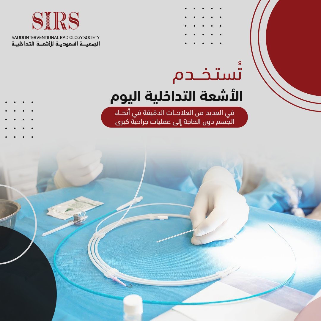 Saudi Interventional Radiology Society (@sirs_ksa) on Twitter photo من الرأس إلى القدمين، تقدم الأشعة التداخلية علاجات دقيقة دون الحاجة للعمليات الجراحية
#SIRS
#Saudi_Interventional_Radiology_Society من الرأس إلى القدمين، تقدم الأشعة التداخلية علاجات دقيقة دون الحاجة للعمليات الجراحية
#SIRS
#Saudi_Interventional_Radiology_Society