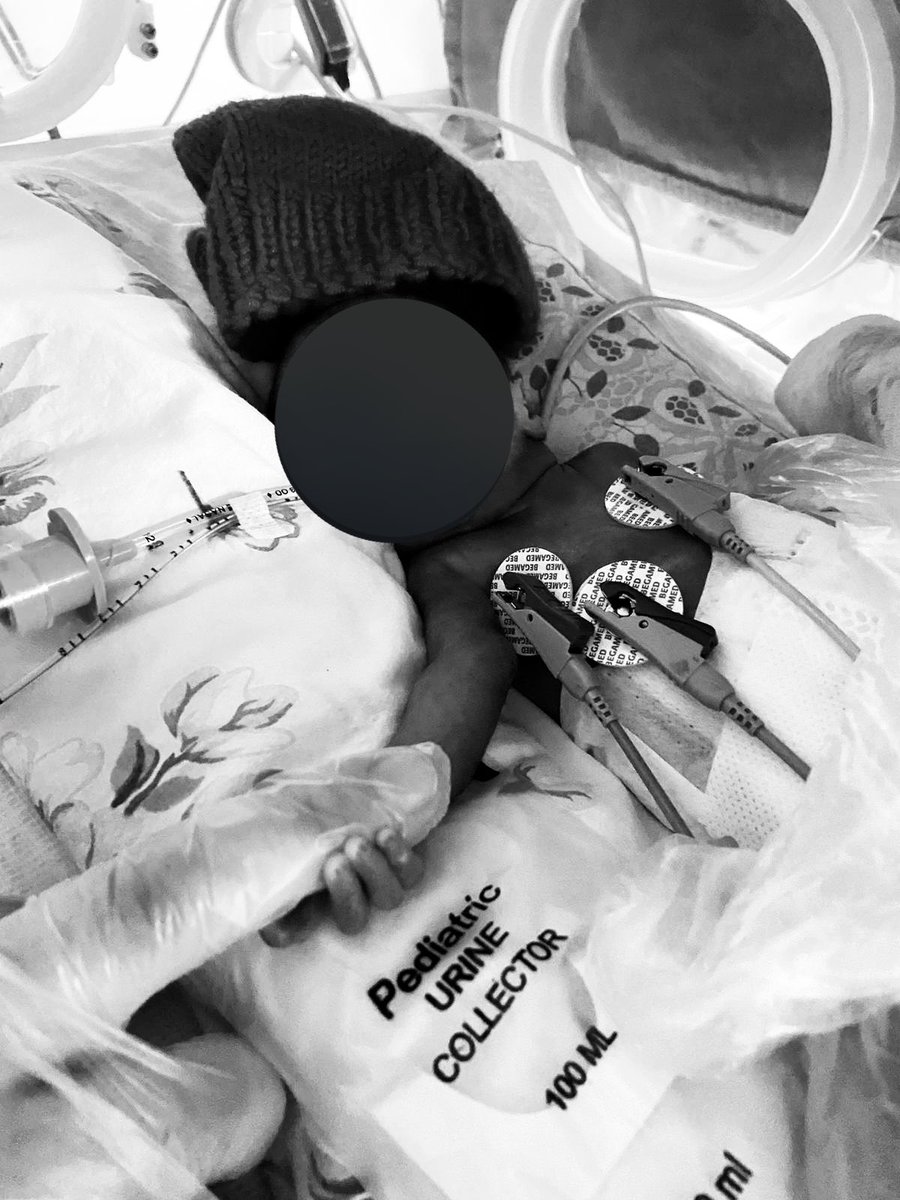 __almi1's tweet photo. Kısacası; minik canlar hayata tutunabilsin diye canını hiçe sayanlar da var.
Lütfen herkesi aynı kefeye koymayın. https://t.co/NE3wvtHGEF