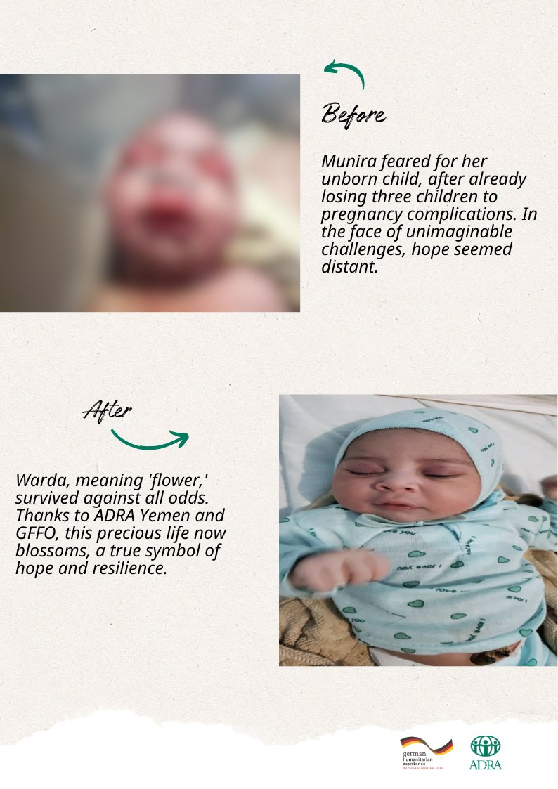 ADRA Yemen (@adrayemen) on Twitter photo "I thought I would lose her," Munira said, holding her newborn. After losing 3 babies, she feared the worst. But thanks to #ADRA & <a href="/GermanyDiplo/">GermanForeignOffice</a> , Warda survived and is now thriving against all odds. 🌸 through the Yemen Emergency Medical Assistance ( YEMA) Project. #healthcare "I thought I would lose her," Munira said, holding her newborn. After losing 3 babies, she feared the worst. But thanks to #ADRA & <a href="/GermanyDiplo/">GermanForeignOffice</a> , Warda survived and is now thriving against all odds. 🌸 through the Yemen Emergency Medical Assistance ( YEMA) Project. #healthcare