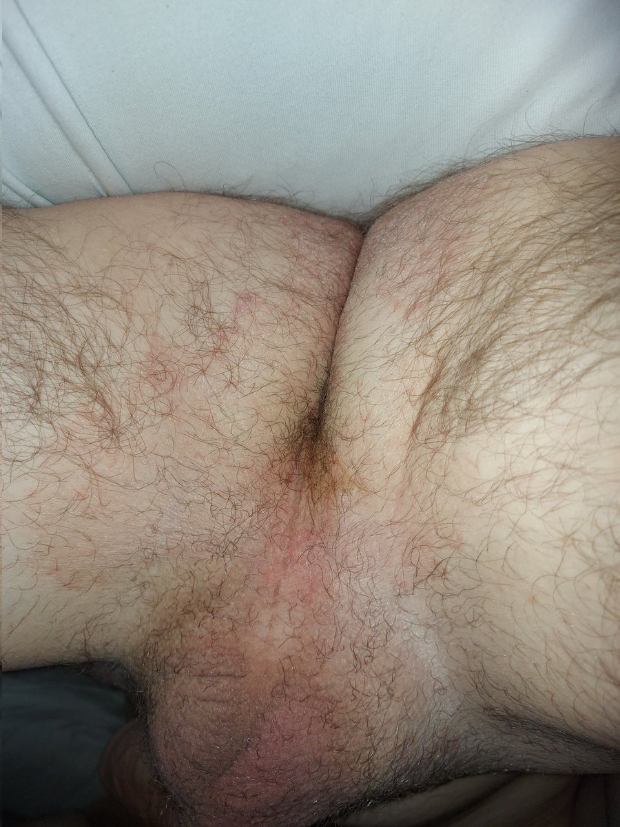 Jayboy92nl's tweet photo. I need a shave! #gay #hairy #cock #dick #ass #fuck #smooth #cum #hung #twink https://t.co/8nPLnwLc7A