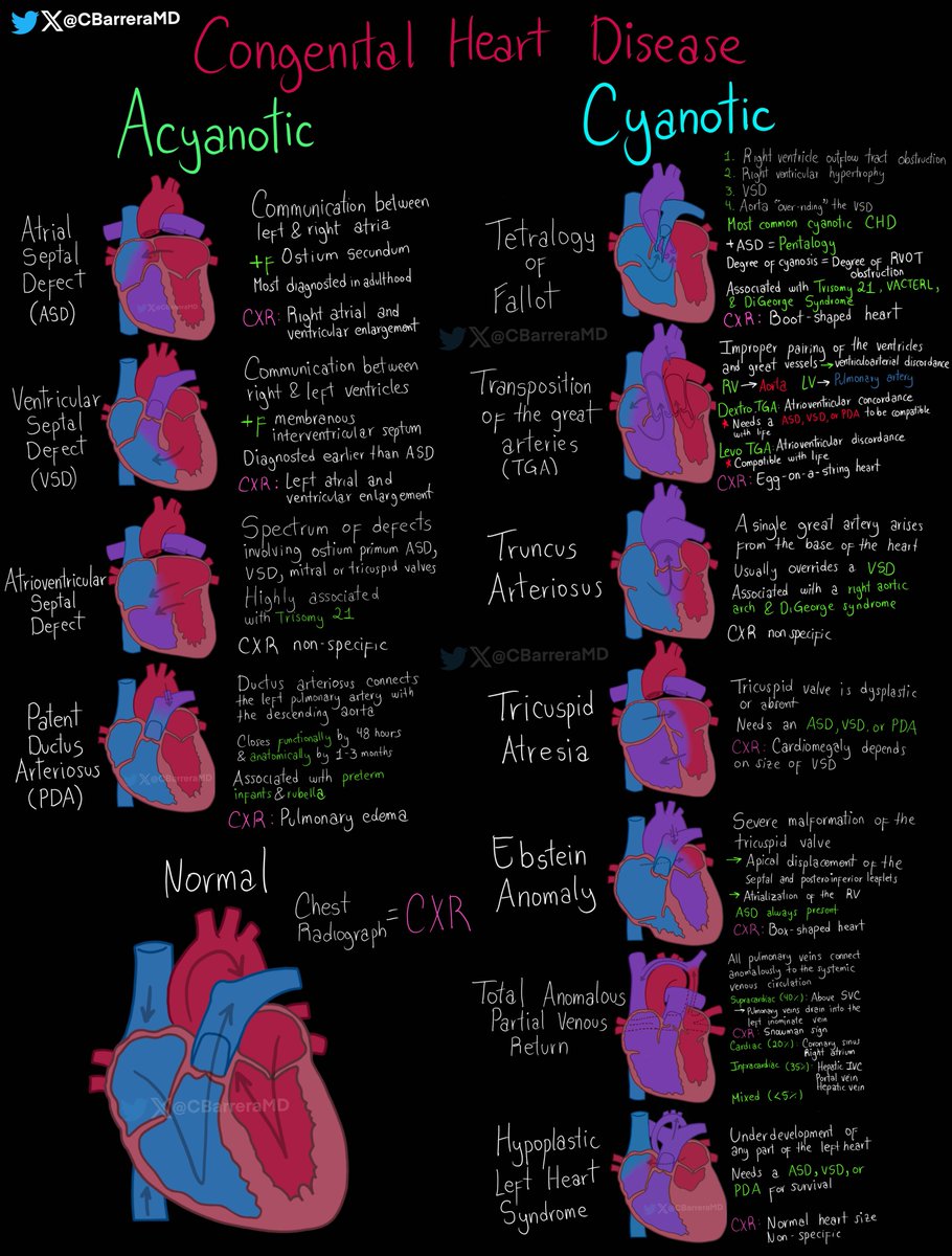 Congenital Heart Disease🫀

A summary of the main features of the most common congenital anomalies

#MedEd #MedTwitter #cardiology #pediatrics #CardioTwitter #CardioEd