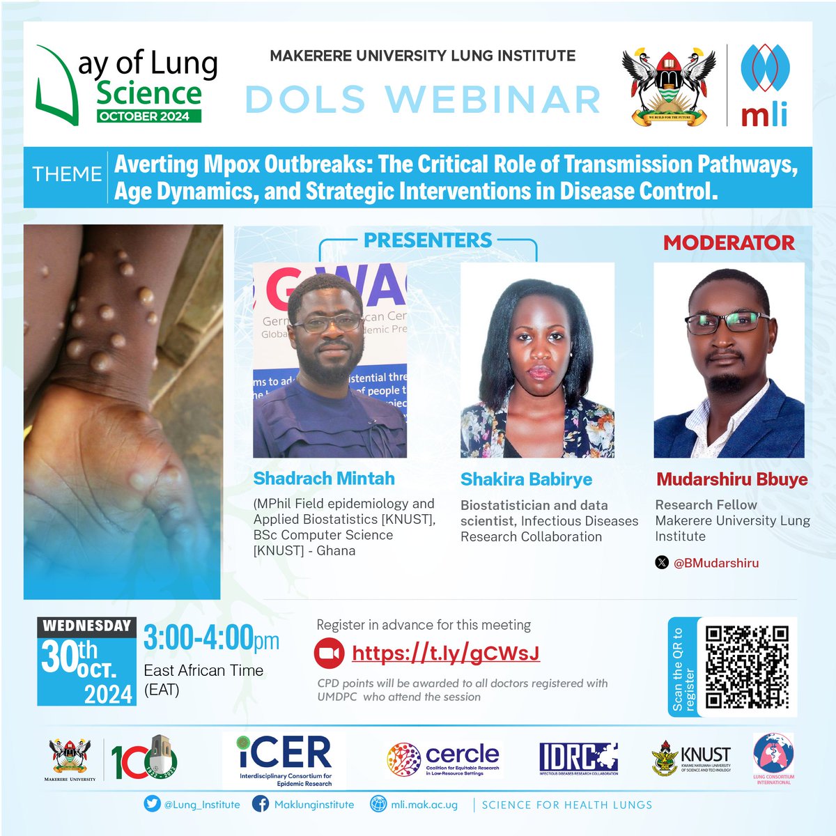 Lung_Institute's tweet photo. 📢 Join the Day of Lung Science
🗓️ 30th Oct 2024, 3pm
🎯 Topic: Averting Mpox Outbreaks
👨🏿💻 Presenters: Shadrach Mintah @KNUSTGH & Shakira Babirye @IDRC_Uganda
🧑🏿💼 Moderator: @BMudarshiru
📍 Register now: https://t.co/vPpp3WjThq
@brucekirenga @Hskyobe #ICER https://t.co/Ov3ixk2T2x