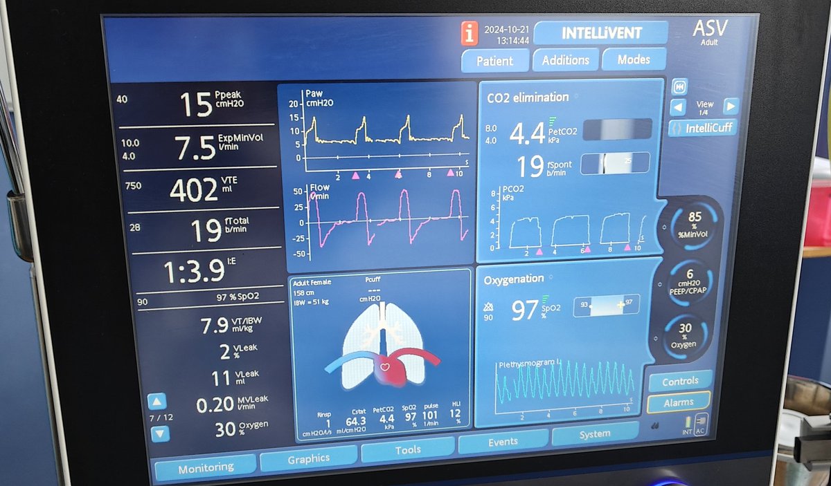 DrAaronCorp's tweet photo. First day of using Intellivent on ICU with thanks to @HamiltonMedical @chftanaesthesia @CHFTNHS @Sir_SR https://t.co/D0j5hYJ6v2