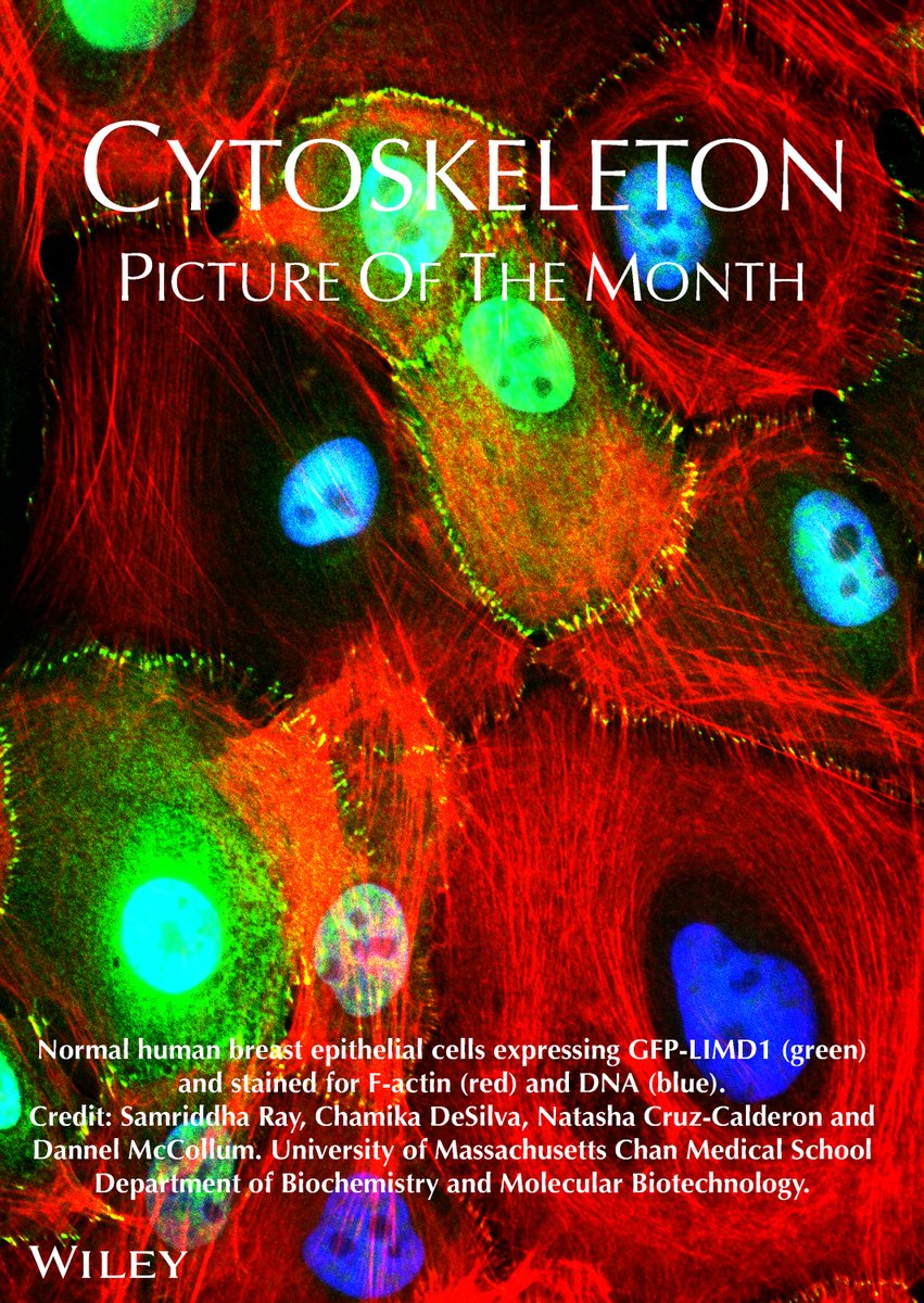 Cytoskeleton Journal (@cytoskeljournal) on Twitter photo Happy #microscopymonday! This week we have one of our <a href="/CytoskelJournal/">Cytoskeleton Journal</a> #Pictures of the month. Normal #human breast epithelial #cells expressing GFP-LIMD1 (green) and stained for F-actin (red) and #DNA (blue).<a href="/samriddha_ray/">Dr Samriddha Ray</a> #cytoskeleton #actin onlinelibrary.wiley.com/doi/full/10.10… Happy #microscopymonday! This week we have one of our <a href="/CytoskelJournal/">Cytoskeleton Journal</a> #Pictures of the month. Normal #human breast epithelial #cells expressing GFP-LIMD1 (green) and stained for F-actin (red) and #DNA (blue).<a href="/samriddha_ray/">Dr Samriddha Ray</a> #cytoskeleton #actin onlinelibrary.wiley.com/doi/full/10.10…
