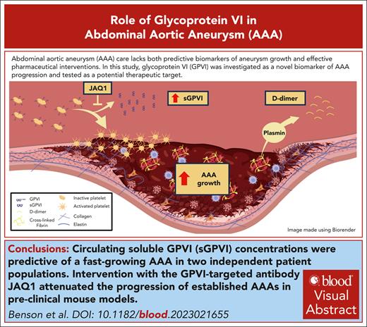 sGPVI, a platelet-derived blood biomarker, is predictive of AAAs, with high specificity in distinguishing patients with rapidly growing AAA. ow.ly/kkMR50TNNm2 #plateletsandthrombopoiesis #plenarypapers #vascularbiology