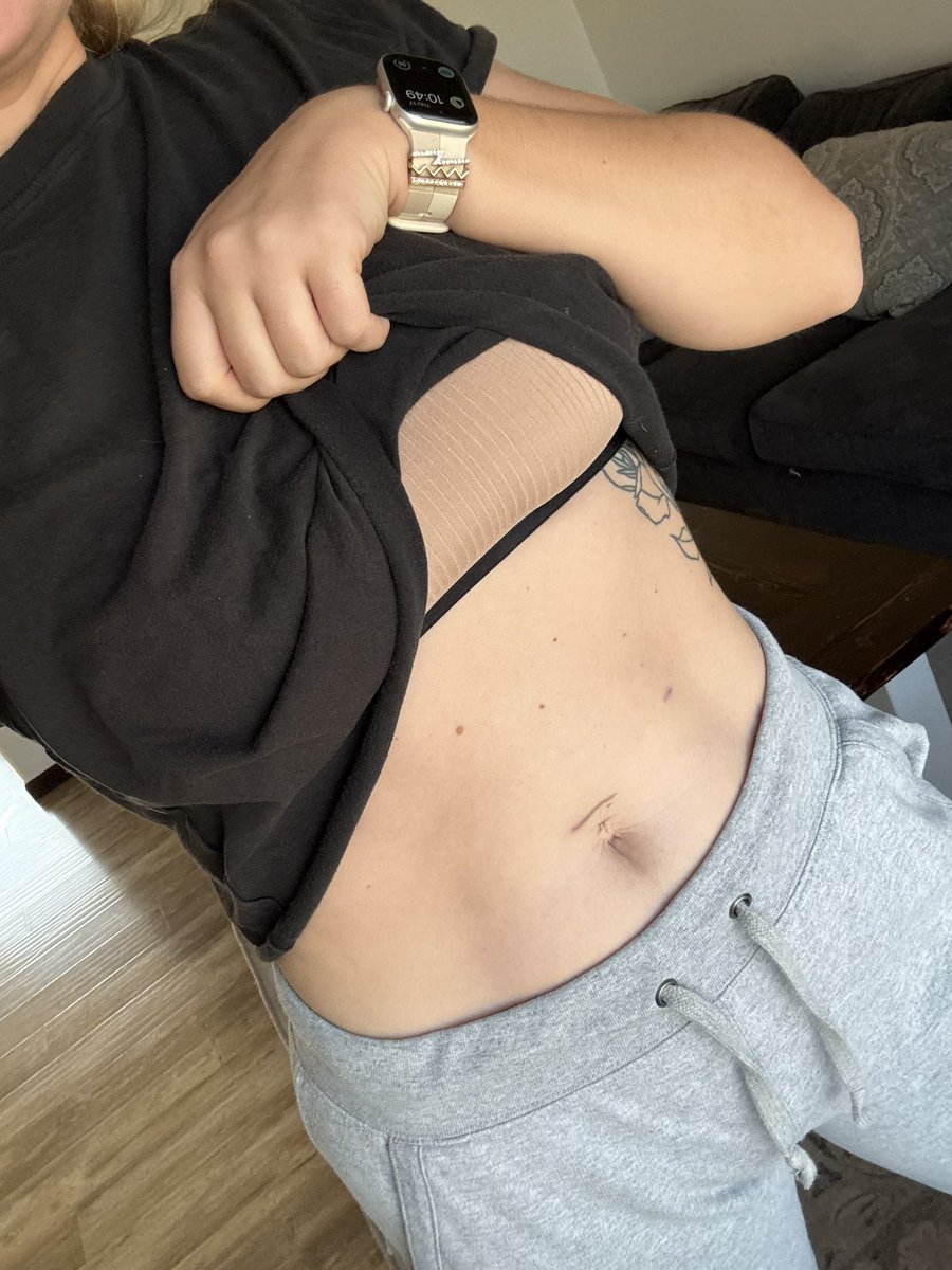 Slowly getting core strength back after surgery! #MotivationalMonday