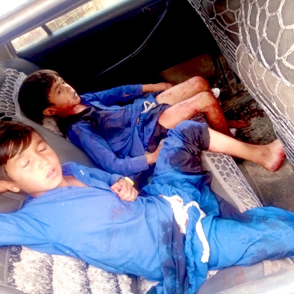 SaleemAfridii's tweet image. ضلع خیبر وادی تیراہ کے علاقہ ذخہ خیل پیر میلہ بازار میں اج دن کے دو بجےکے درمیان ظالم اور امن کی دشمن ریاست پاکستانی فوج کی طرف سے ڈرون حملہ کیا گیا ہیں جس میں کئ لوگ زخمی ہوگئے ہیں زخمیوں میں بچے شامل ہیں زخمیوں کو حیات آباد میڈیکل کمپلیکس پشاور لائے گئے ہیں
جبکہ کچھ زخمیوں کو