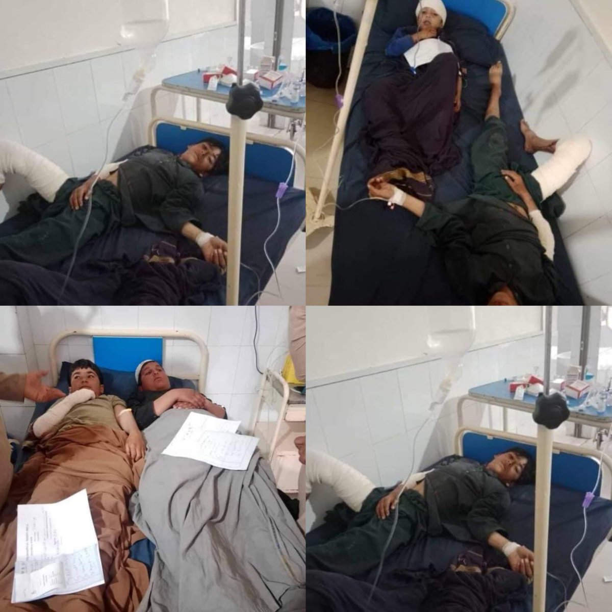 SaleemAfridii's tweet image. ضلع خیبر وادی تیراہ کے علاقہ ذخہ خیل پیر میلہ بازار میں اج دن کے دو بجےکے درمیان ظالم اور امن کی دشمن ریاست پاکستانی فوج کی طرف سے ڈرون حملہ کیا گیا ہیں جس میں کئ لوگ زخمی ہوگئے ہیں زخمیوں میں بچے شامل ہیں زخمیوں کو حیات آباد میڈیکل کمپلیکس پشاور لائے گئے ہیں
جبکہ کچھ زخمیوں کو