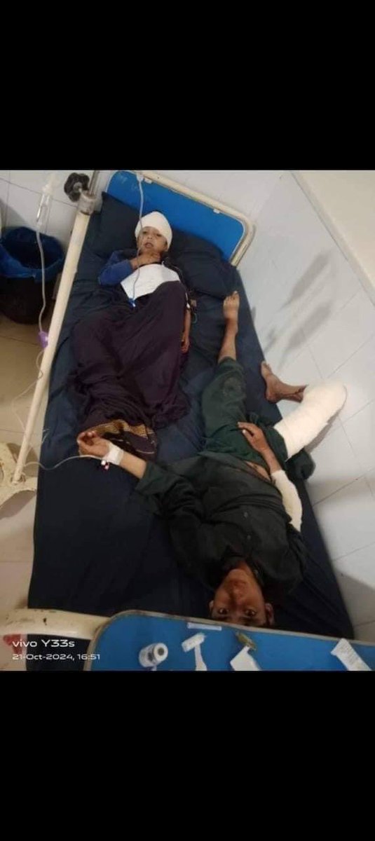 SaleemAfridii's tweet image. ضلع خیبر وادی تیراہ کے علاقہ ذخہ خیل پیر میلہ بازار میں اج دن کے دو بجےکے درمیان ظالم اور امن کی دشمن ریاست پاکستانی فوج کی طرف سے ڈرون حملہ کیا گیا ہیں جس میں کئ لوگ زخمی ہوگئے ہیں زخمیوں میں بچے شامل ہیں زخمیوں کو حیات آباد میڈیکل کمپلیکس پشاور لائے گئے ہیں
جبکہ کچھ زخمیوں کو