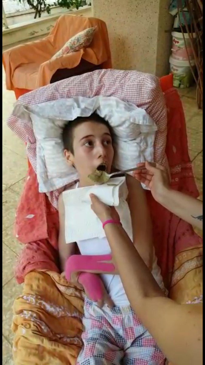 Neyse çok uzatmayacagım sapasağlam götürdügüm kardesimi bu halde geri aldık biz hastaneden. Şuan göremiyor konusamıyor hareket edemiyor vs. Yani cansu doğuştan böyle değil arkadaslar. Kardesim bir doktor ihmali sonucu bu halde!