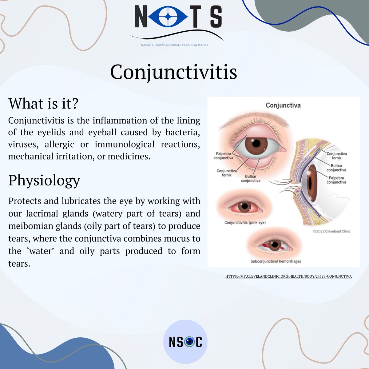 NatOphthalTeach's tweet photo. We are back with another of our fact sheets, this time on conjunctivitis!

Keep a look out for our fact sheets which will be posted every 2 weeks ☺️

If you have any suggestions/ questions, don’t hesitate to contact us 👀

Author: Vyom Patel https://t.co/A8khbxeCFY