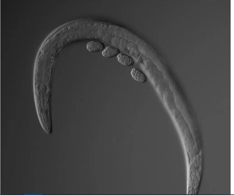 UW Medicine Newsroom (@uwmnewsroom) on Twitter photo In <a href="/nytimes/">The New York Times</a> item by <a href="/teddyrosenbluth/">Teddy Rosenbluth</a> hailing the many contributions of research on the tiny roundworm C. elegans to science, Dr. Bob Waterston <a href="/uwgenome/">UW Genome Sciences</a> <a href="/UWMedicine/">UW Medicine</a> said, “If we understand the worm, we understand life." tinyurl.com/2x7cbzue In <a href="/nytimes/">The New York Times</a> item by <a href="/teddyrosenbluth/">Teddy Rosenbluth</a> hailing the many contributions of research on the tiny roundworm C. elegans to science, Dr. Bob Waterston <a href="/uwgenome/">UW Genome Sciences</a> <a href="/UWMedicine/">UW Medicine</a> said, “If we understand the worm, we understand life." tinyurl.com/2x7cbzue