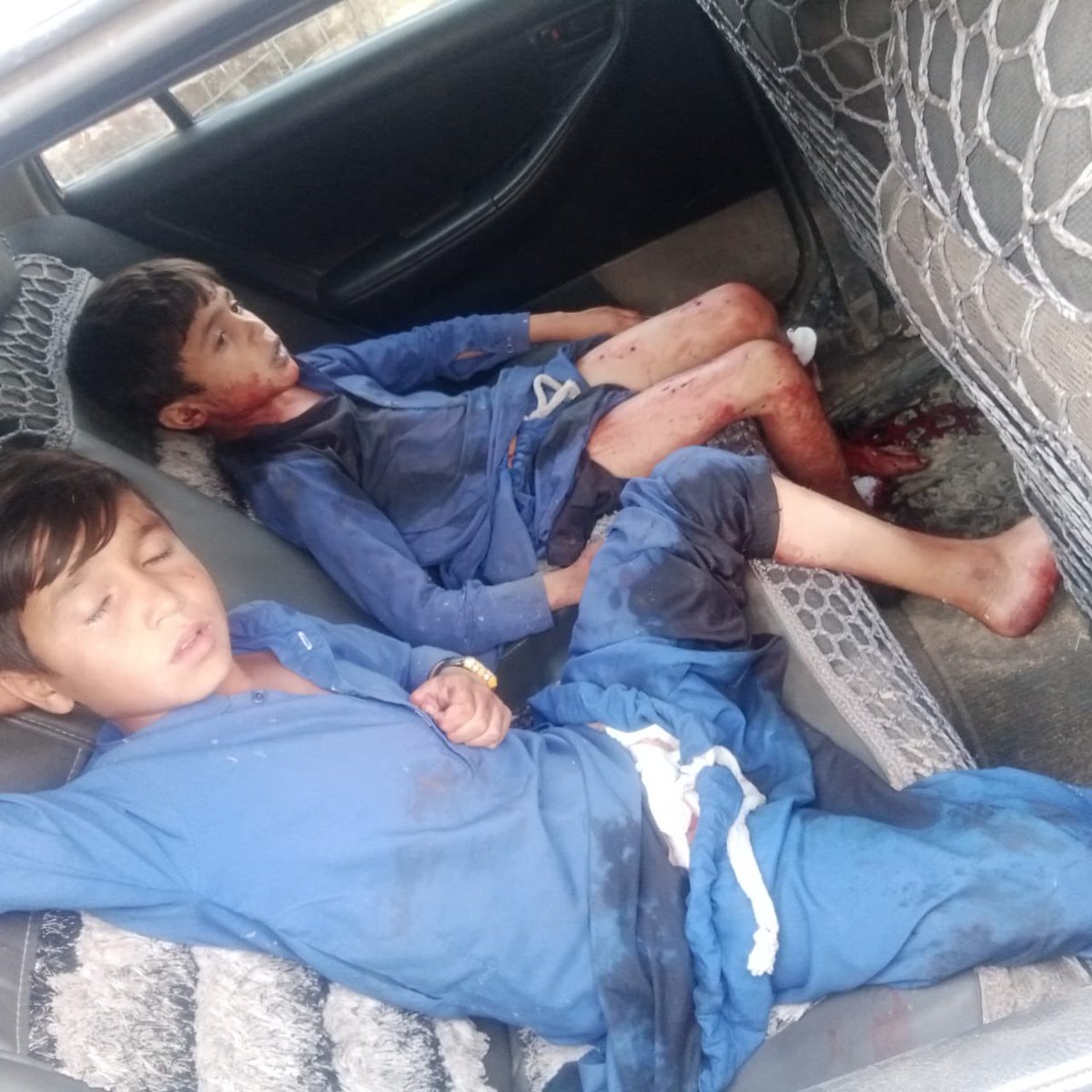 ManzoorPashteen's tweet photo. وادی تیراہ زخہ خیل پیر میلہ بازار پر پاکستانی فضائی حملہ، جس میں درجنوں عام عوام زخمی، زخمیوں میں کم عمر بچے بھی شامل ہے۔
زخمیوں کو حیات آباد میڈیکل کمپلیکس پشاور پہنچایا گیا ہے تحریک کے دوست بلڈ ڈونیشن کے لئے پہنچ جائے۔
پشتون بیلٹ میں جنگی پالیسیوں پر عمل درآمد کرنے میں مسلسل ناکامی کے بعد ریاست نے عوامی مقامات پر حملے شروع کئے ہیں۔
جتنا زور لگانا ہے لگا لو مگر ہم پشتون وطن پر ڈالری جنگیں ہونے نہیں دینگے۔