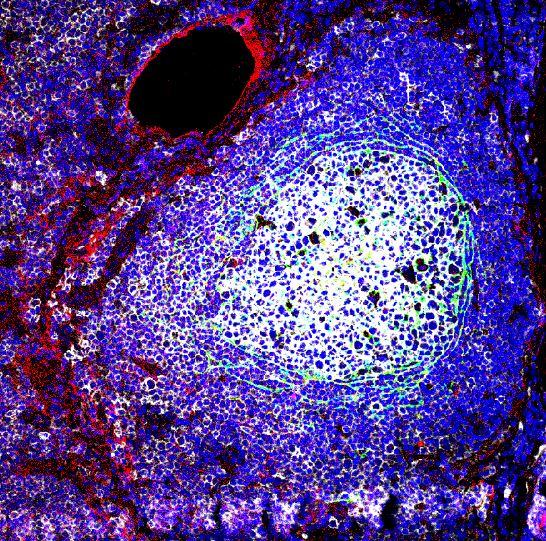 Dr Alan G Ramsay (@ramsaylab) on Twitter photo 🚨MRC-iCASE PhD studentship available🚨to join my lab at <a href="/KingsCollegeLon/">King's College London</a> and study lymph node stroma-immune interactions in lung cancer to improve immunotherapy.
🗓️Closing date Tue 29 October 1PM
<a href="/KCL_MRCDTP/">KCL MRC DTP</a> #MRCDTP25 #PhDposition #London #AstraZeneca
tinyurl.com/44s9upep 🚨MRC-iCASE PhD studentship available🚨to join my lab at <a href="/KingsCollegeLon/">King's College London</a> and study lymph node stroma-immune interactions in lung cancer to improve immunotherapy.
🗓️Closing date Tue 29 October 1PM
<a href="/KCL_MRCDTP/">KCL MRC DTP</a> #MRCDTP25 #PhDposition #London #AstraZeneca
tinyurl.com/44s9upep
