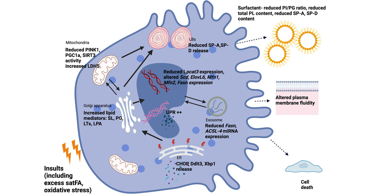 ATS Red Journal (@ajrcmb) on Twitter photo Reexamining the Role of Pulmonary Lipids in the Pathogenesis of Pulmonary Fibrosis
<a href="/atscommunity/">American Thoracic Society (ATS)</a>
🔗 tinyurl.com/3pahkz2t Reexamining the Role of Pulmonary Lipids in the Pathogenesis of Pulmonary Fibrosis
<a href="/atscommunity/">American Thoracic Society (ATS)</a>
🔗 tinyurl.com/3pahkz2t