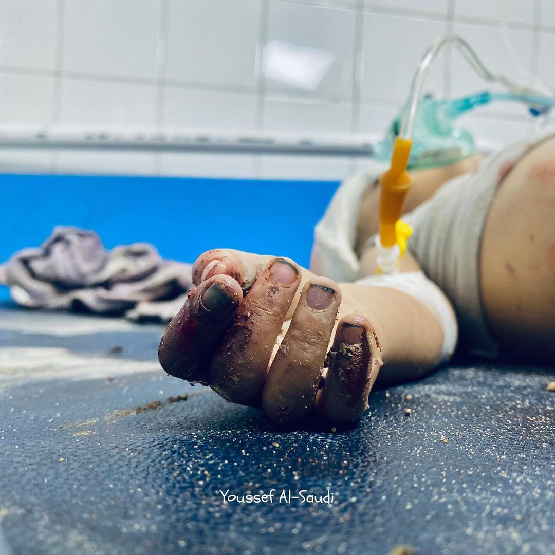 MineEmir676's tweet photo. Sağlık ekipleri, Gazze'deki işgal baskınlarında yaralanan çocuğu kurtarmaya çalışıyor.!
Ya-Şafii
Ya-Hafız Ya-Adl Ya-Şafii Ya-Mucib Ya-Fettah Ya-Kahhar Ya-Aziz Ya-Müntekim Ya-Mani Ya-Hafid Ed-Darr Ya-Selam Ya-Semi🤲🏻🇵🇸
#TeroristAmericaEnglandChinaBM #SivasKYKBoykot #StopMasacre https://t.co/6pIXyVQVMQ