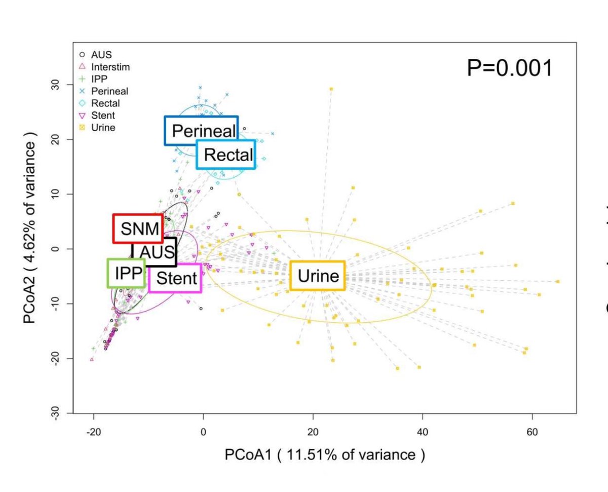 We characterize biofilm across urologic devices: AUS, IPP, SNM, stent.  Unique relative to their surrounding environments.  What can we learn from their commonalities and differences?  How similar are device biofilms from those of other specialties? Free:
doi.org/10.1016/j.urol…