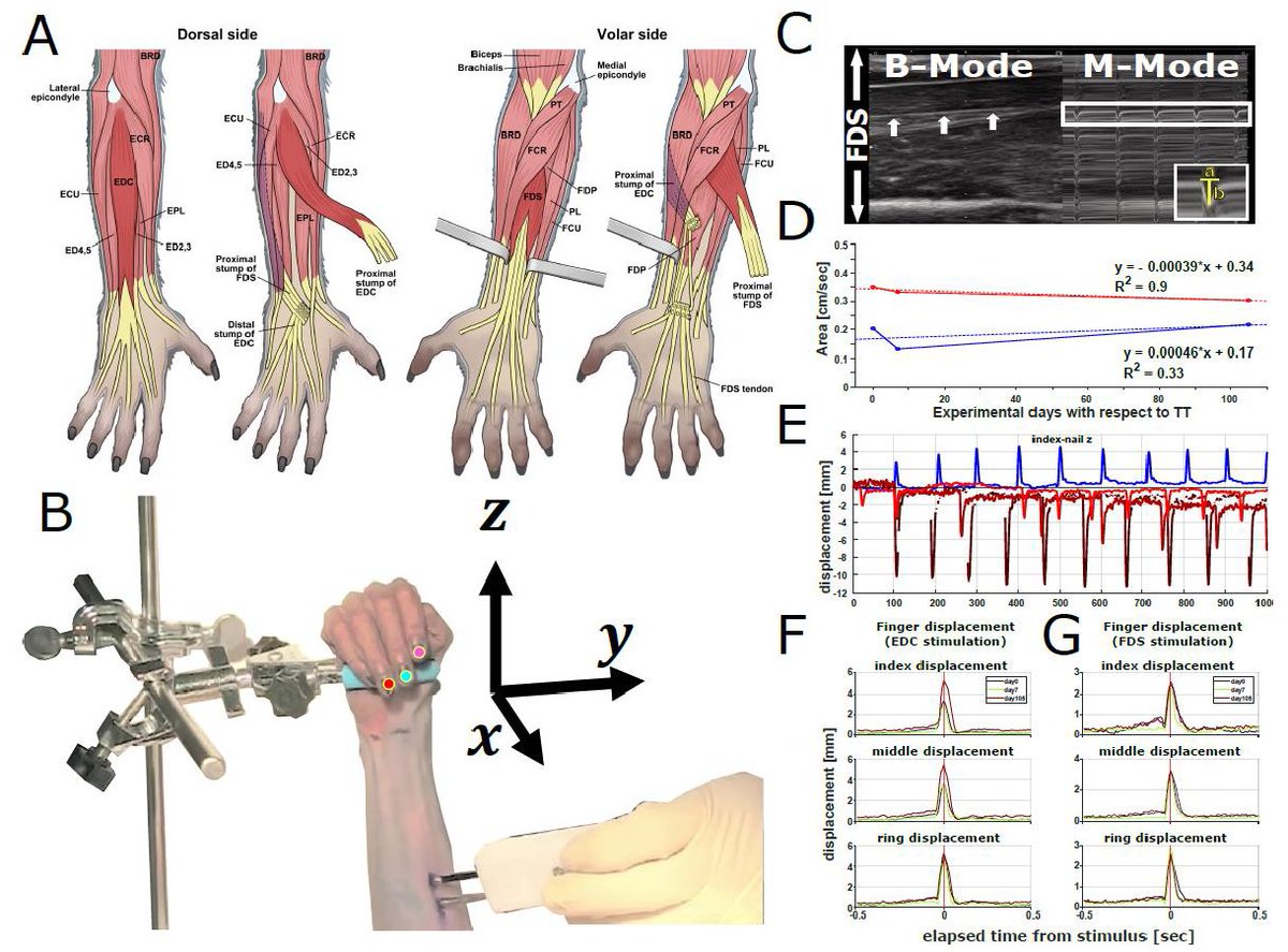 Finally! Still needs to go through peer review but having it out on <a href="/biorxiv_neursci/">bioRxiv Neuroscience</a> is a very important first step. Fingers crossed 🤞<a href="/SekiLabs/">SekiLabs</a> <a href="/ValeroLab/">ValeroLab</a> <a href="/OyaTomomichi/">tomomichi oya</a> <a href="/NCNP_PR/">NCNP（国立精神・神経医療研究センター）</a> <a href="/ncm_soc/">NCM society</a> #tenodesis #tendon_transfer #musclesynergy #electromyography