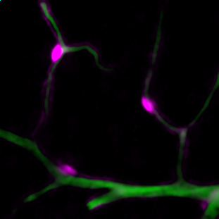 Jake_Cashion_'s tweet image. Our new paper published in @BrainBehavImm shows ablating pericytes in mice causes hypoactivity🏃, motor impairment, vessel dysfunction🩸, and widespread gliosis🌟. Another reminder of how important pericytes are for brain function.
@BradASutherland @LabGlial (1/3)