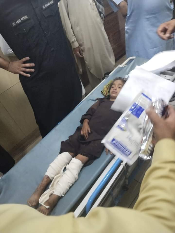 ArbabMahsud's tweet photo. کل وادی تیراہ زخہ خیل پیر میلہ بازار پر پاکستانی فضائی حملہ، جس میں درجنوں عام عوام زخمی، زخمیوں میں کم عمر بچے بھی شامل ہے۔ جتنا زور لگانا ہے لگا لو مگر ہم پشتون وطن پر ڈالری جنگیں ہونے نہیں دینگے۔

مجھے امید ہے کہ ہمیشہ کی طرح پاکستانی مجاہدین خاموشی کو ذریعہ نجات سمجھتے ہوئے https://t.co/IGpJGmq5Gf