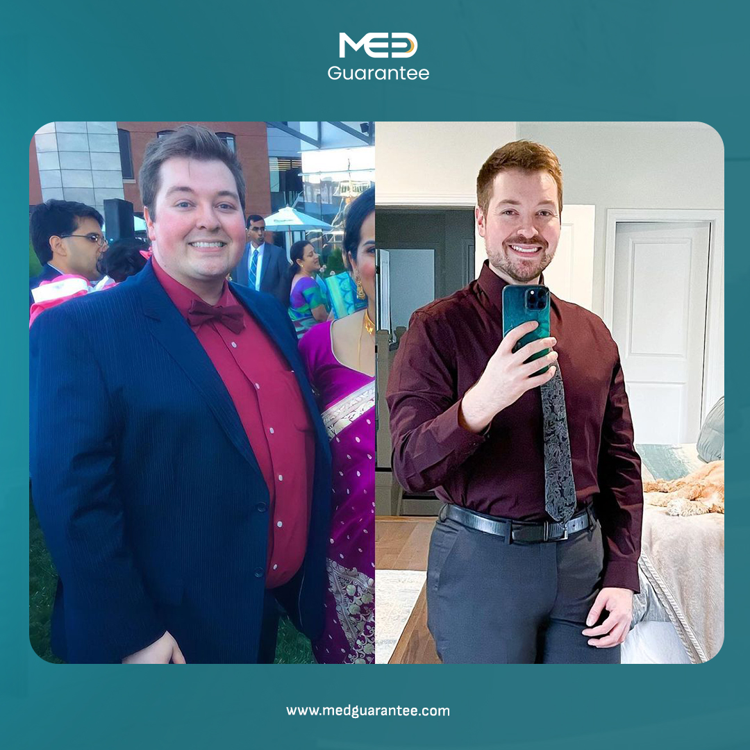 Medguarantee's tweet photo. ✨Gastric sleeve surgery transformed my life🌟

🤩Transform your life with expert gastric sleeve care😇

👇 Contact Us:
🌐 https://t.co/gqGxhXhgTQ
📲 https://t.co/ygRHEBaAlV
📞 +90 850 441 9109

#GastricSleeve
#Health https://t.co/vXJW114YvF