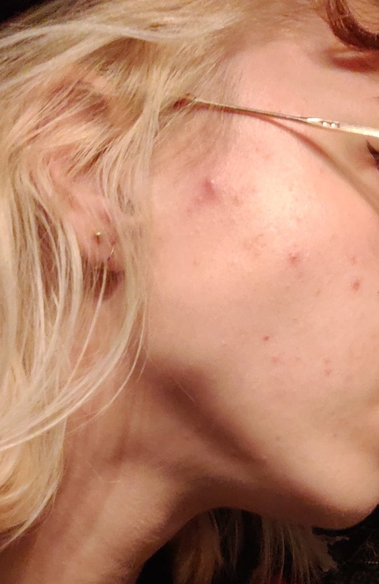 • 𝔸 𝕍 𝕀 • tweet media