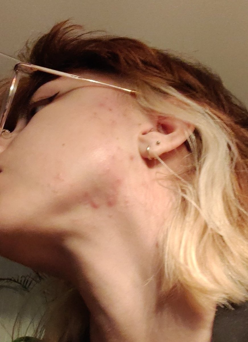 • 𝔸 𝕍 𝕀 • tweet media