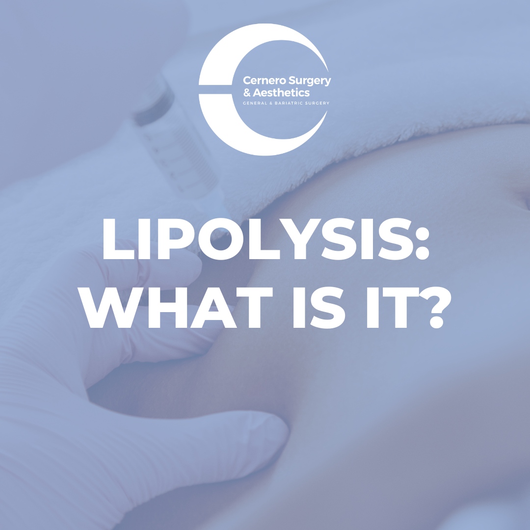 CerneroSurgery's tweet photo. Lipolysis refers to the "melting" of fat cells in a targeted area. This process reduces fat in that region without surgery, like liposuction. We offer multiple non-invasive fat reduction treatments. Schedule a consultation to learn more. https://t.co/8wOIajOdg9 https://t.co/IdXFOKvyYW