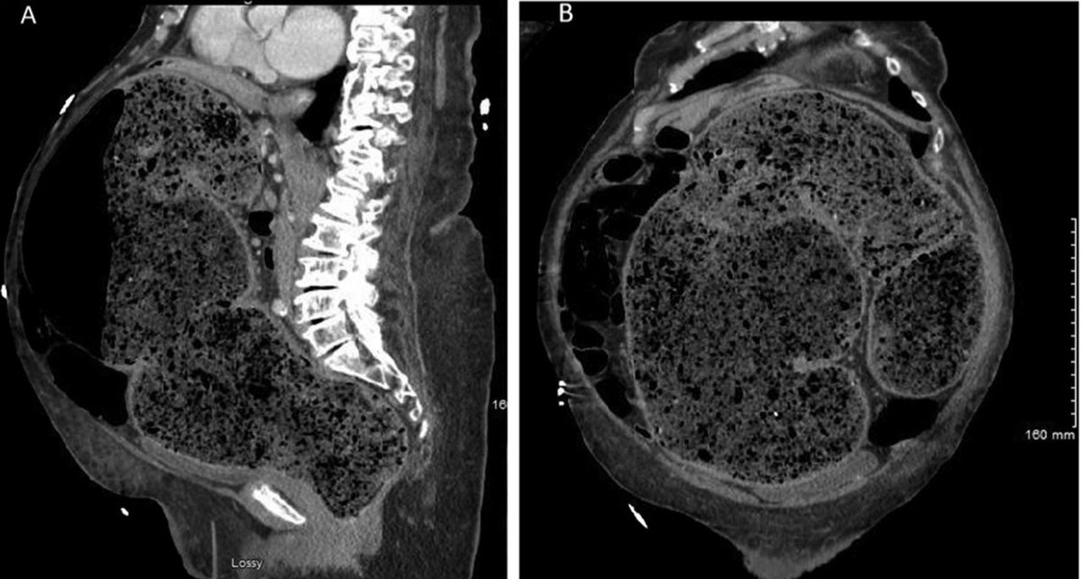 Keith Siau tweet media