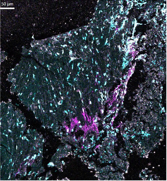 SevdeAltuntas's tweet image. Spatial tarama verilerimiz gelmiştir.. ❤️ #AltuntasLab